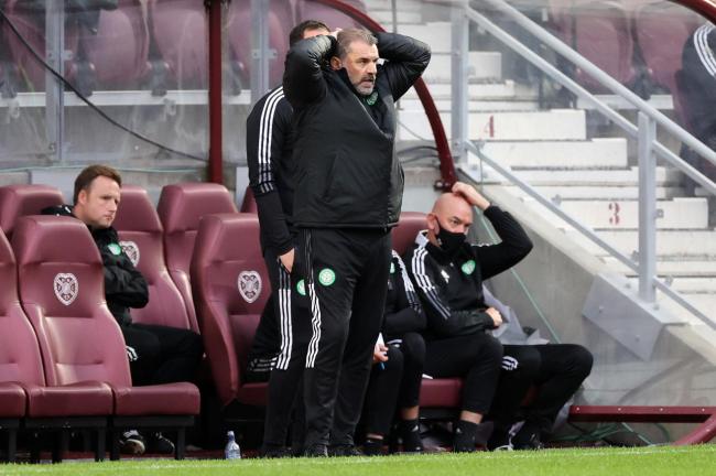 Ange Postecoglou says that Celtic have improved since their opening day Premiership defeat to Hearts at Tynecastle.